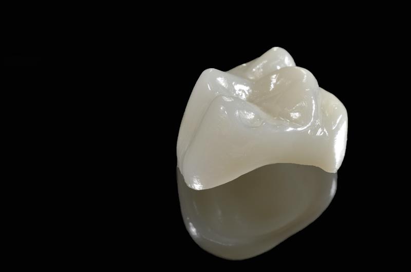 Porcelain Crowns MI